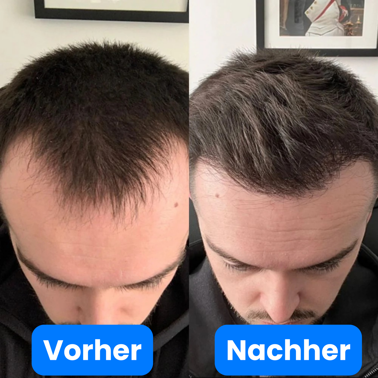 Haar Wachstums Serum