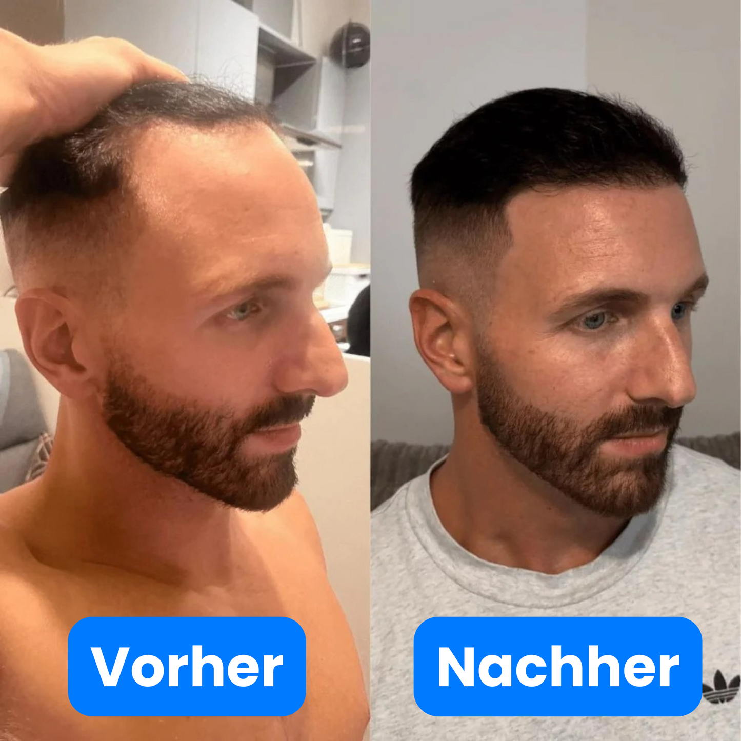 Haar Wachstums Serum