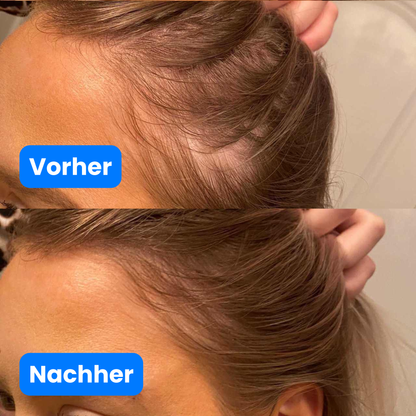 Haar Wachstums Serum